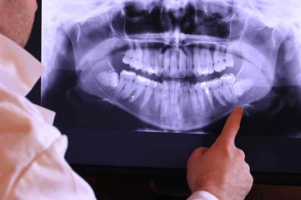 Best Emergency Care for Gum Disease in Pierceton, IN